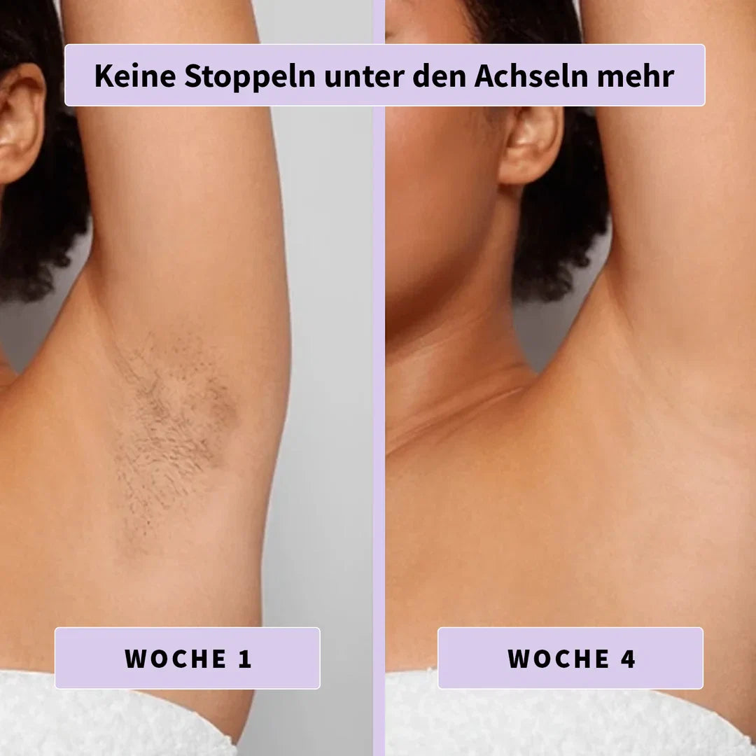 DermaLisse™ – Intensivserum für weniger nachwachsendes Körperhaar