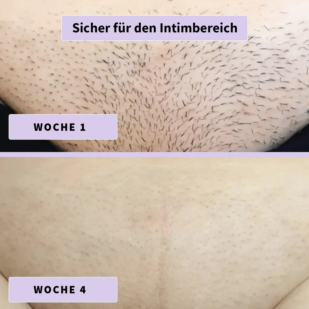 DermaLisse™ – Intensivserum für weniger nachwachsendes Körperhaar