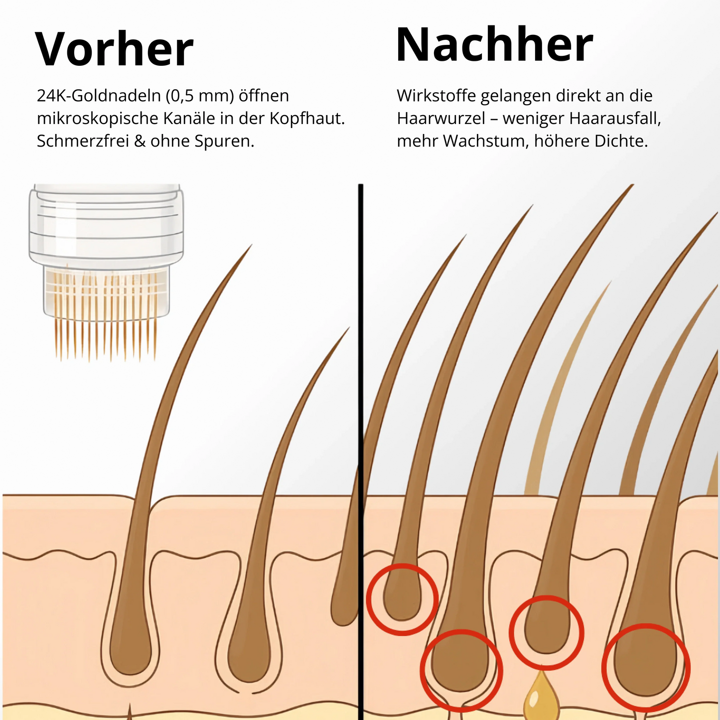 Apex Haarwuchssystem
