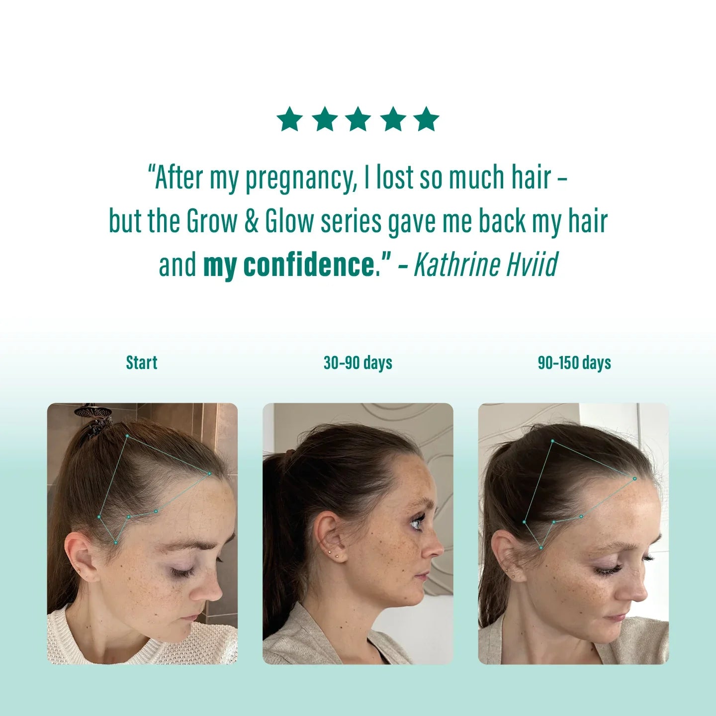 GlowRoot™ – Hair serum for stronger roots & more shine