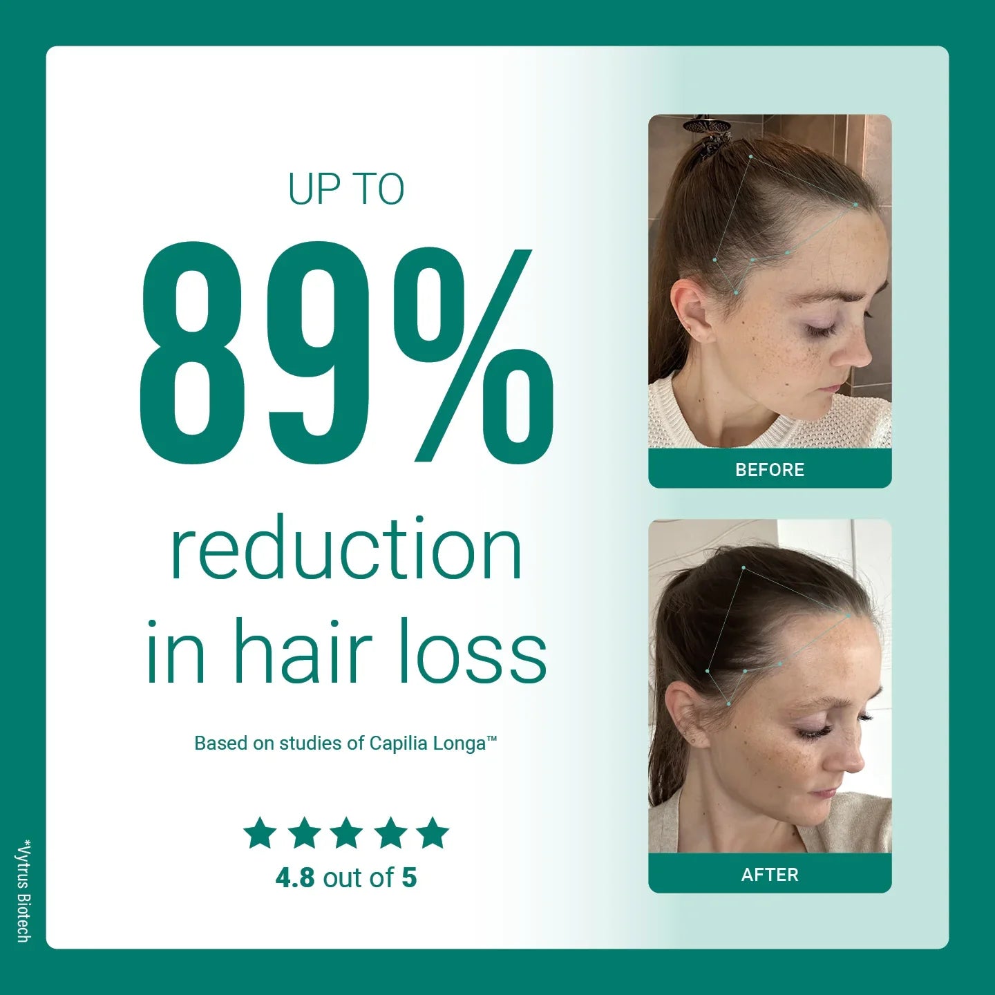 GlowRoot™ – Hair serum for stronger roots & more shine
