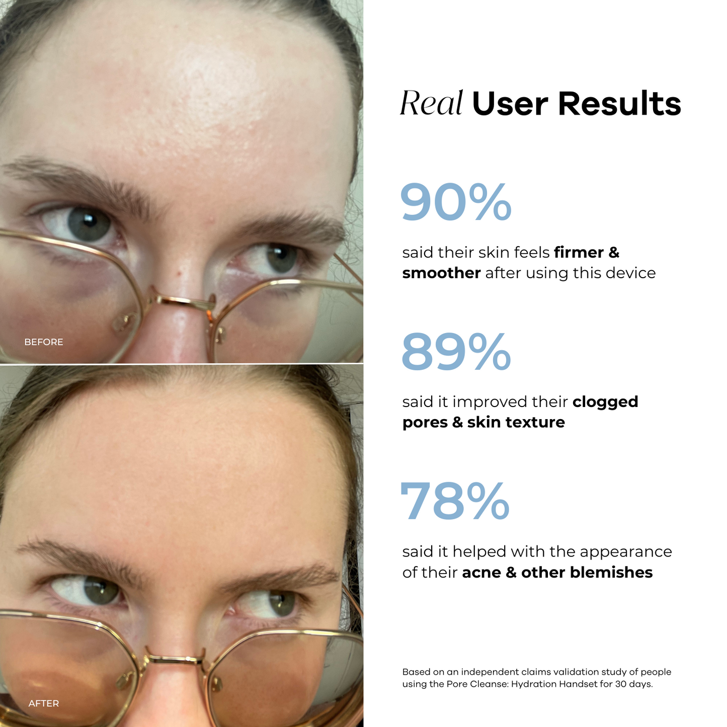 PoreClean™ | Hydration Handset & Hydra Soothe Serum Kit