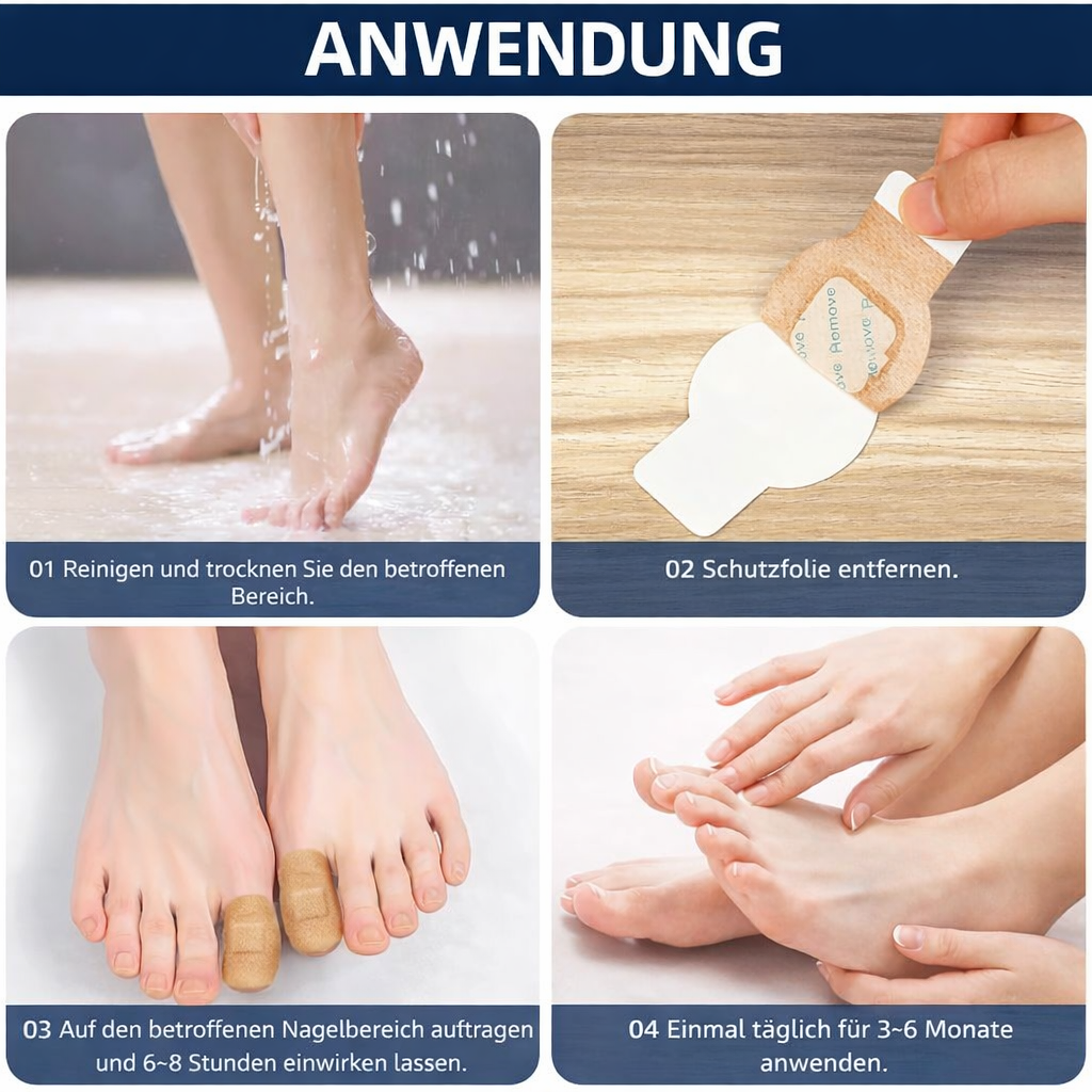 Nevela™ | Pflege-Patches für schöne Fußnägel