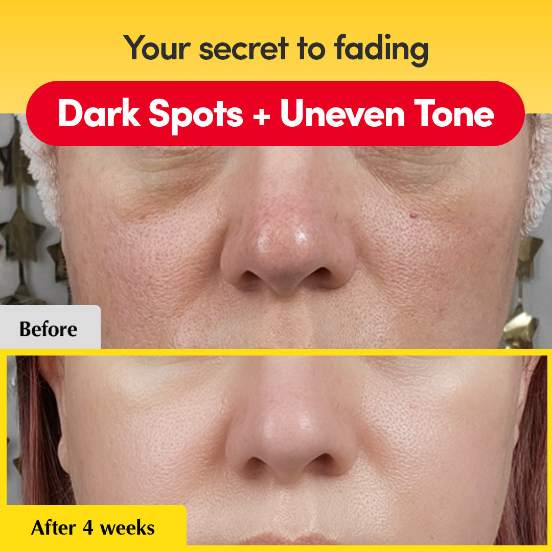Vitamin-Serum gegen dunkle Flecken