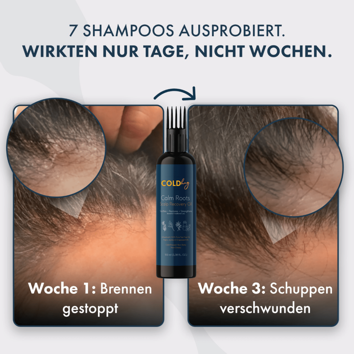 Scalpora™ – Pflegendes Kopfhautöl für eine gesunde Kopfhaut