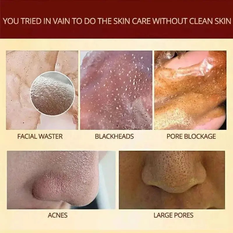 1+1 Gratis | HerbalMask™ | Verfeinernde Peel-Off Gesichtsmaske sanft, effektiv und beruhigend