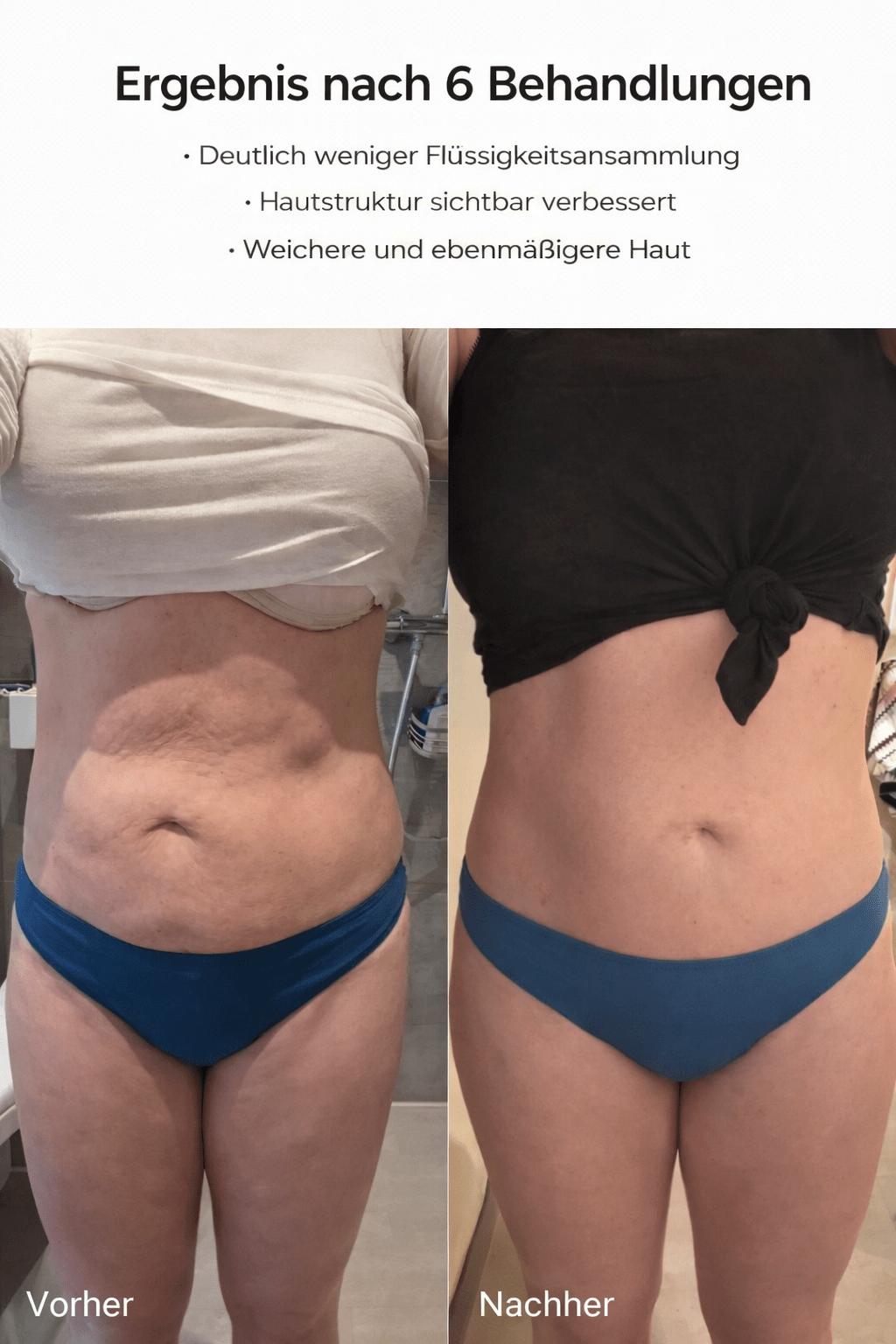 Celluviaa | glatte Haut in 14 Tagen