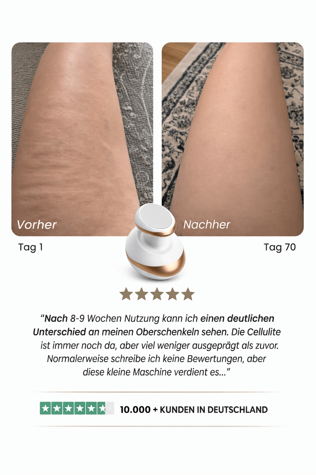 Celluviaa | glatte Haut in 14 Tagen