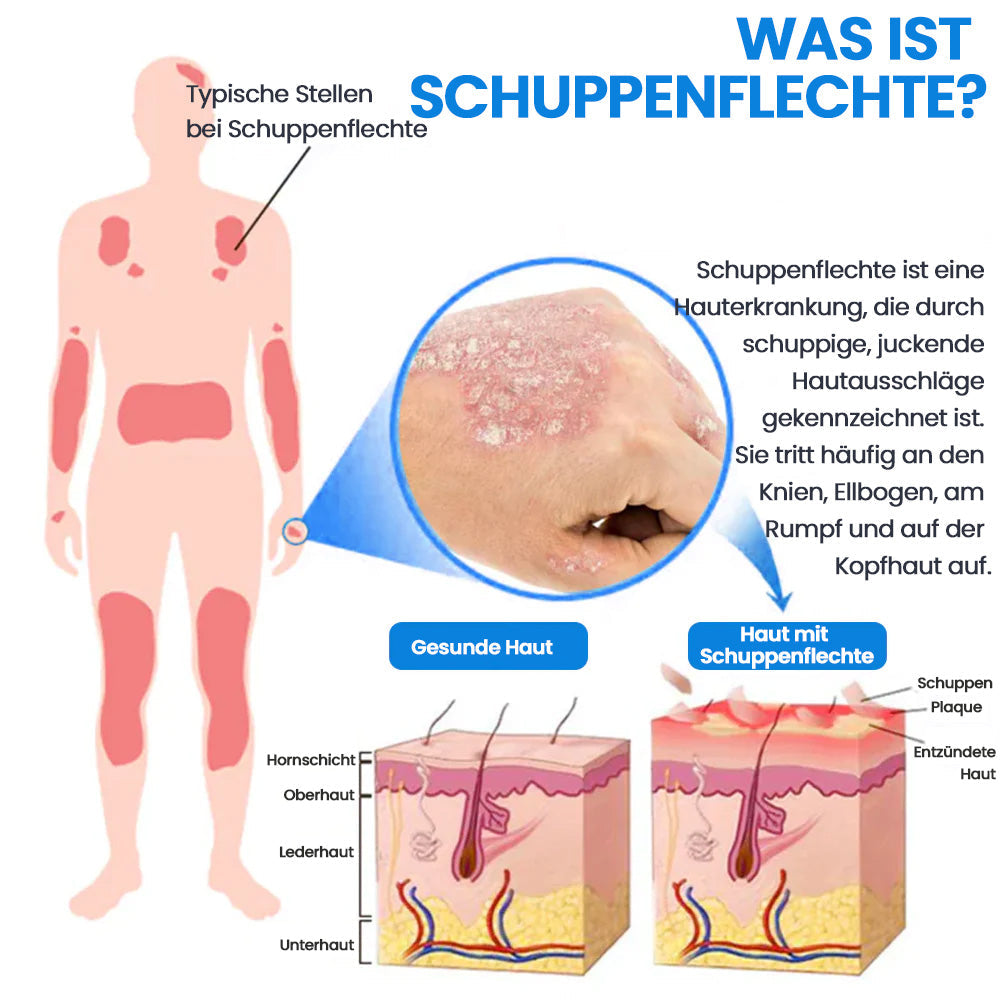 DermaCalm™ – Schnelle Pflege für empfindliche, gereizte Haut | 2 Flashen Bundle