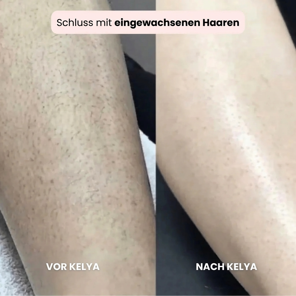 Kelya – Der 2-in-1 Rasierer für empfindliche Haut