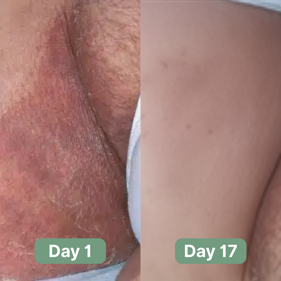 Veloma Antifungale Seife®