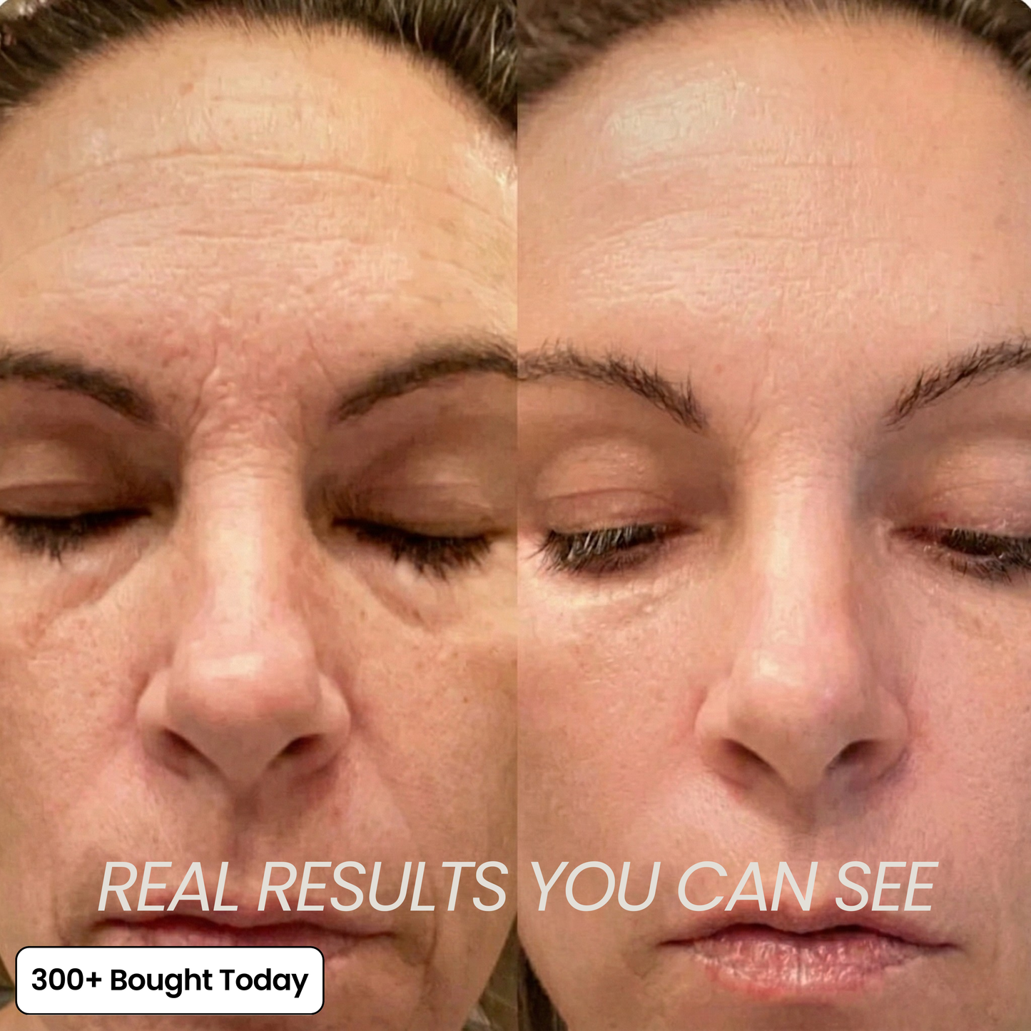 DermaPlump™ – Volumen-Balsam mit Kollagen, PDRN & Hyaluronsäure