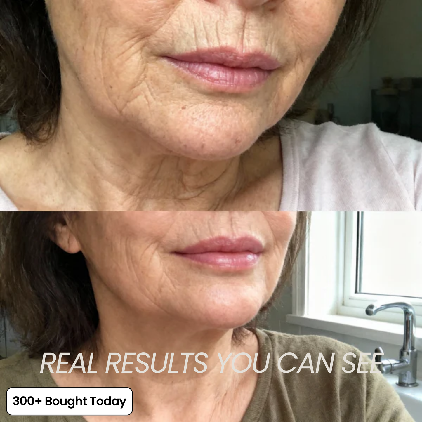 DermaPlump™ – Volumen-Balsam mit Kollagen, PDRN & Hyaluronsäure