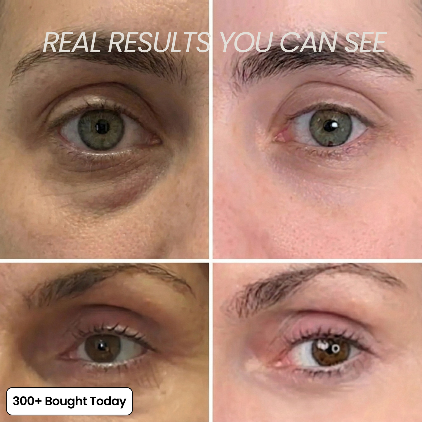 DermaPlump™ – Volumen-Balsam mit Kollagen, PDRN & Hyaluronsäure