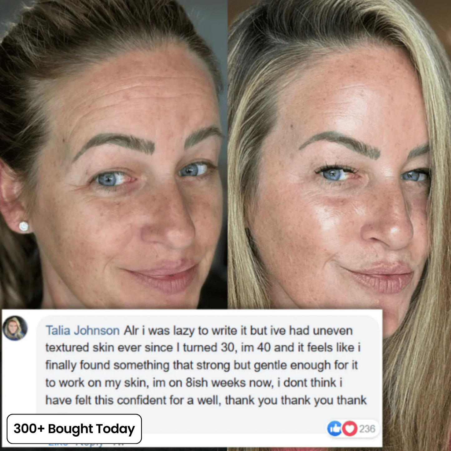 DermaPlump™ – Volumen-Balsam mit Kollagen, PDRN & Hyaluronsäure