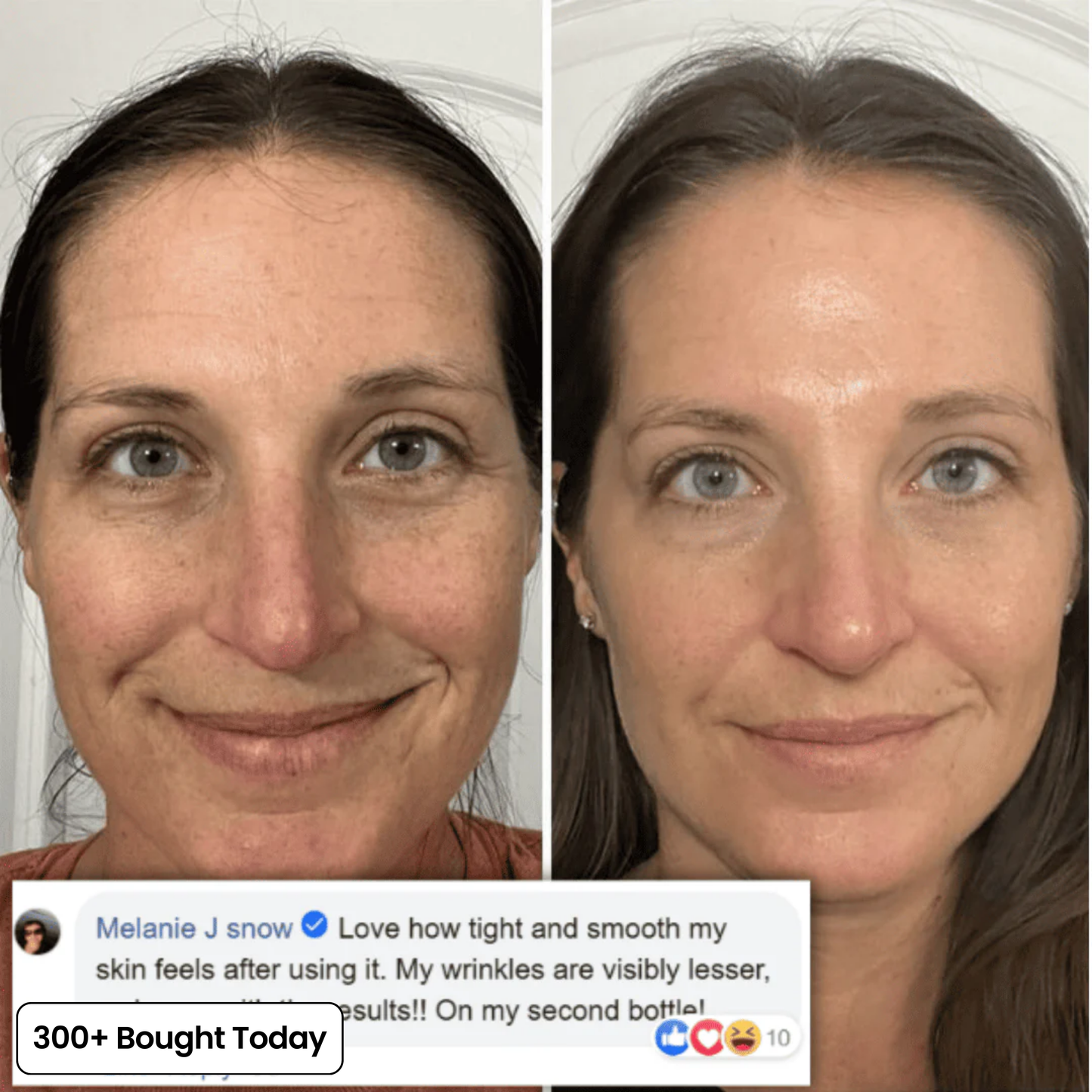 DermaPlump™ – Volumen-Balsam mit Kollagen, PDRN & Hyaluronsäure