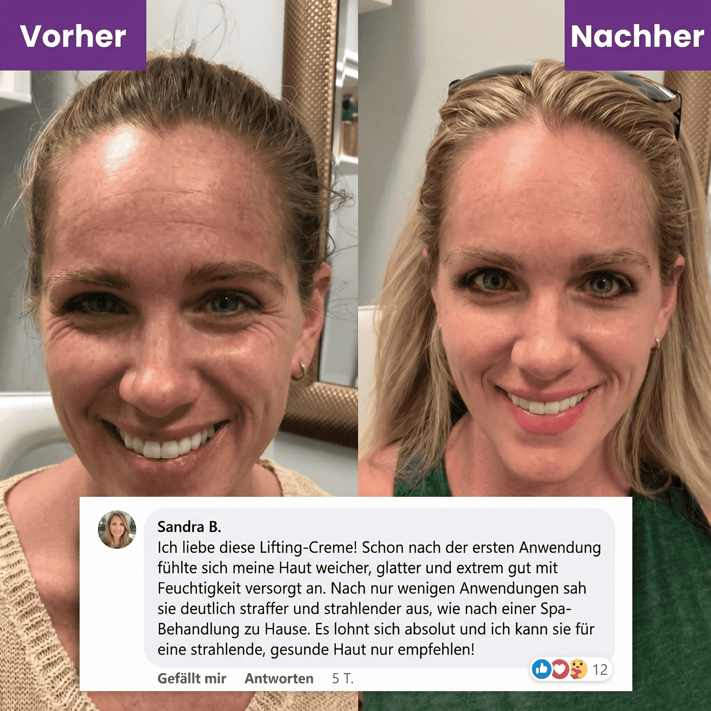 Firmora™ – Peptid-Creme für ein sichtbar glatteres Hautbild