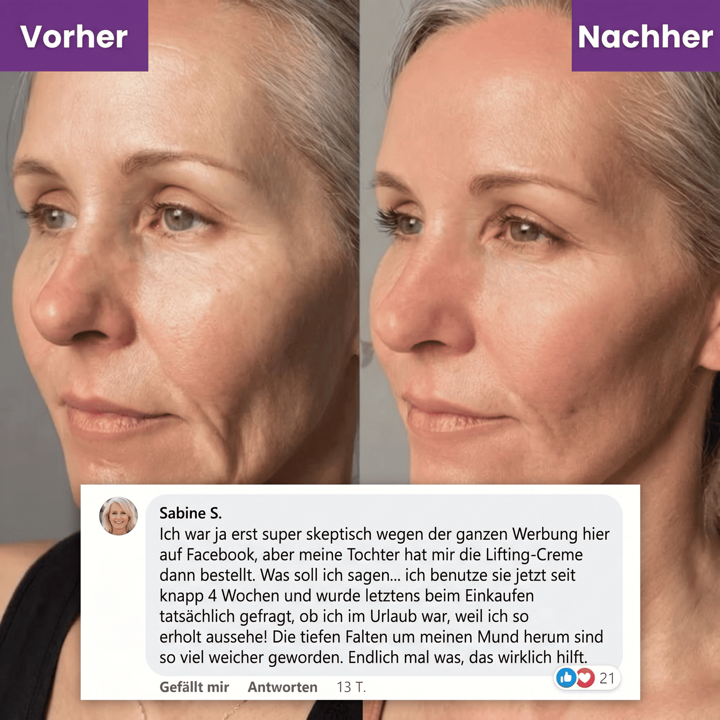 Firmora™ – Peptid-Creme für ein sichtbar glatteres Hautbild