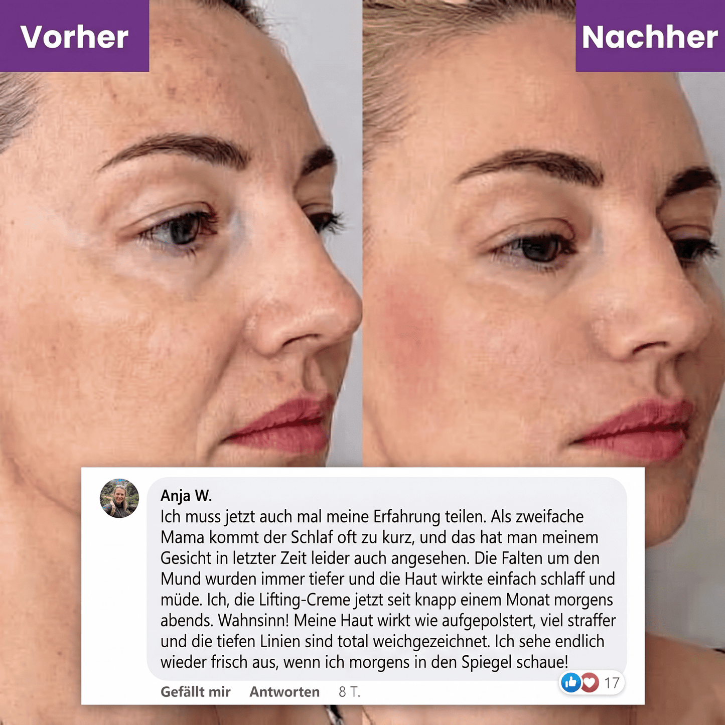 Firmora™ – Peptid-Creme für ein sichtbar glatteres Hautbild