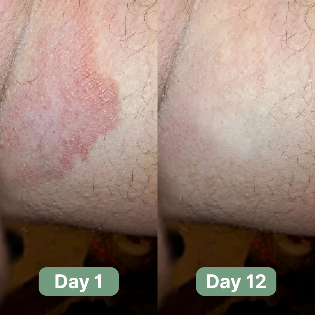 Veloma Antifungale Seife®