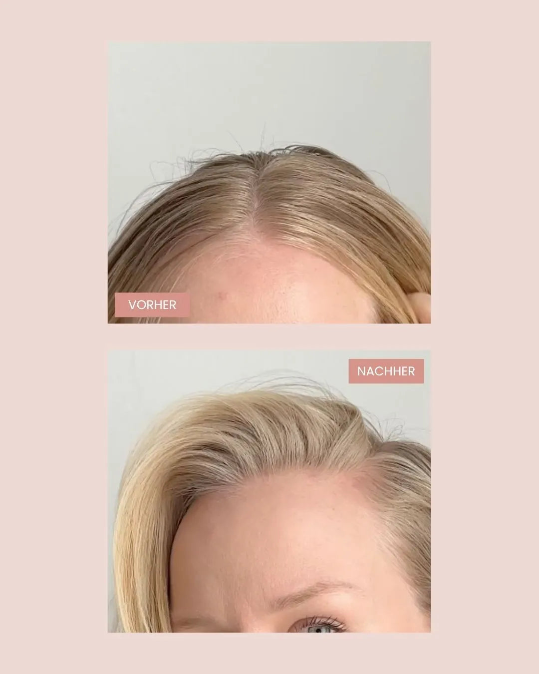 DayFresh™ – Trockenshampoo-Schaum für sofortige Haarfrische unterwegs