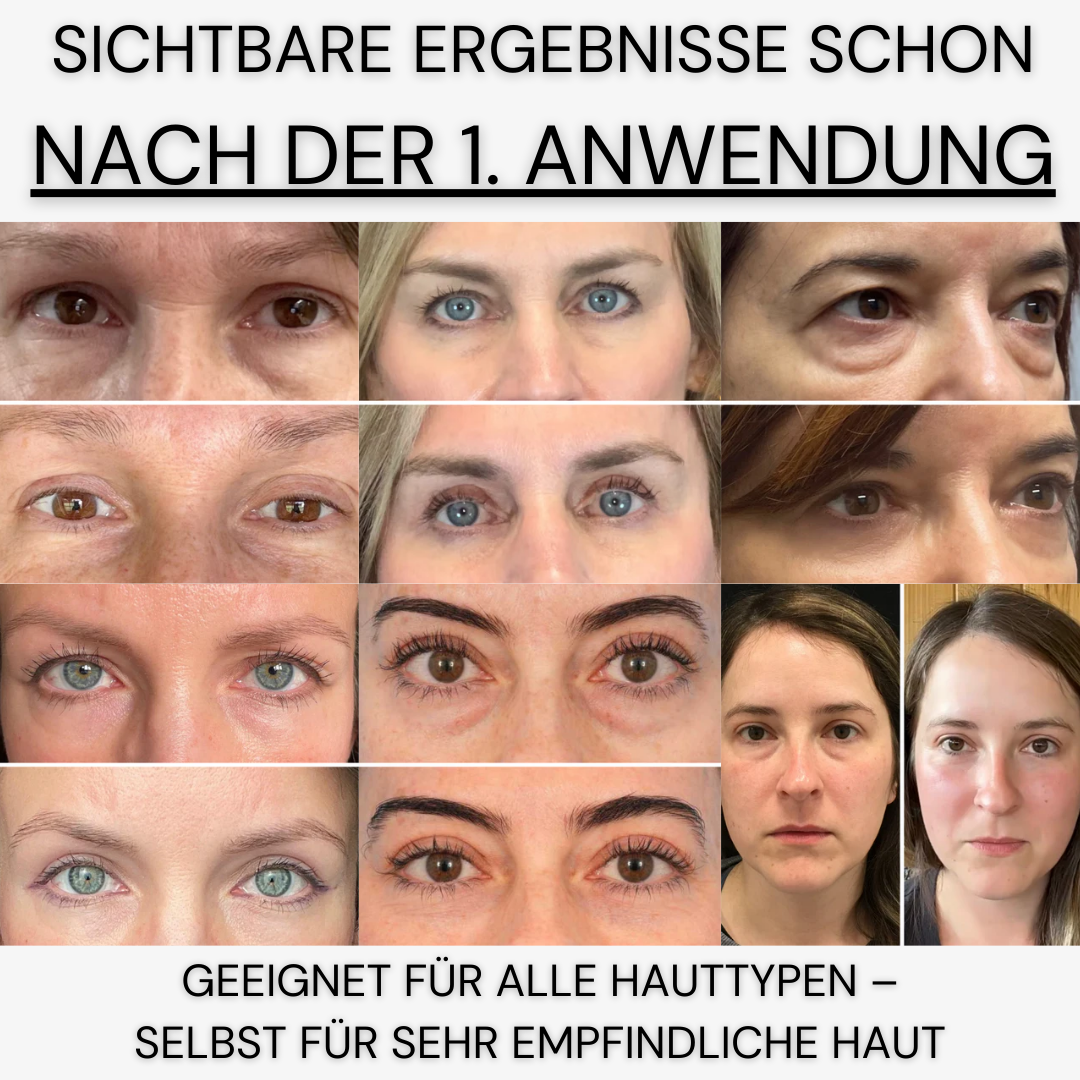InstaLift | Augenpflaster mit PDRN & Kollagen