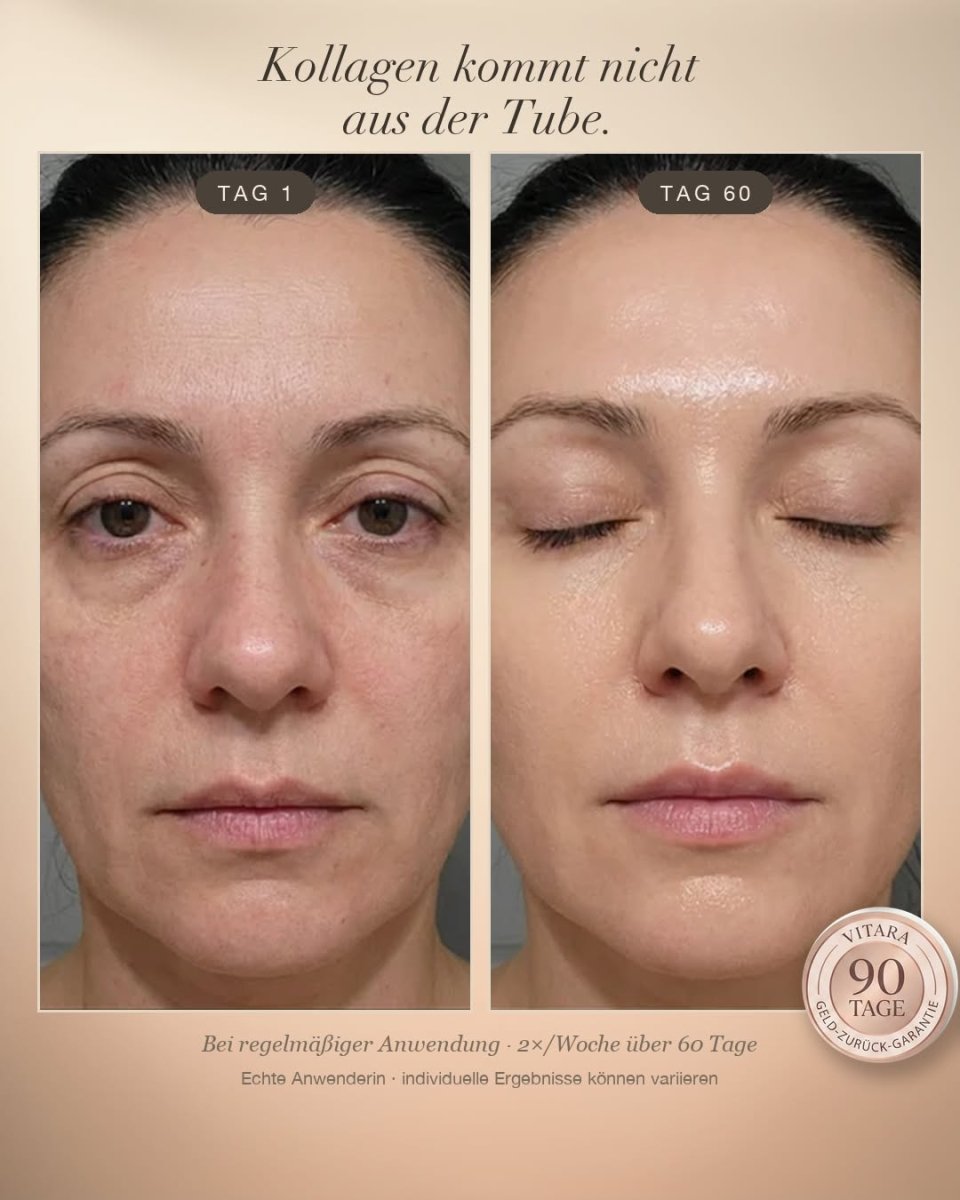 Anti-Falten-Starterset - VITARA Micro-Needling Infusion für zu Hause